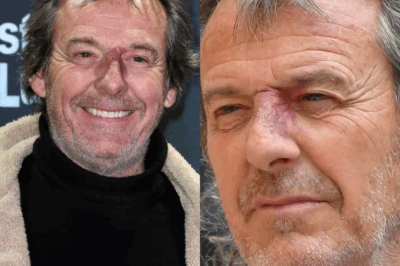 Jean-Luc Reichmann s’est retrouvé en fauteuil roulant : “On se dit que…”