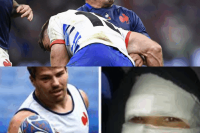 Fracture du visage, fin de carrière à 26 ans ? La terrible blessure d’Antoine Dupont qui a failli briser sa légende à jamais