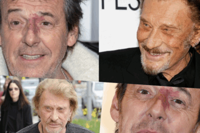 🔥 “Mais qu’est-ce que…” : Johnny Hallyday choqué par le visage de Jean-Luc Reichmann ! Ce qu’il a vu sur son nez l’a littéralement figé. L’angiome, la gêne, l’humiliation… Ce moment que l’animateur n’a jamais oublié, entre blessure intime et révélation publique. Ce que le rockeur a dit ensuite a glacé tout le plateau.