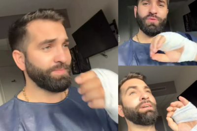 Kendji Girac blessé et bandage à la main : avant de se faire opérer, il explique ce qui lui est arrivé